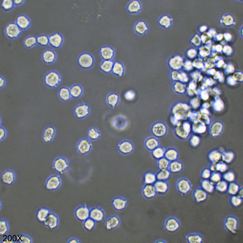 Kasumi-1 人急性髓母白血病细胞