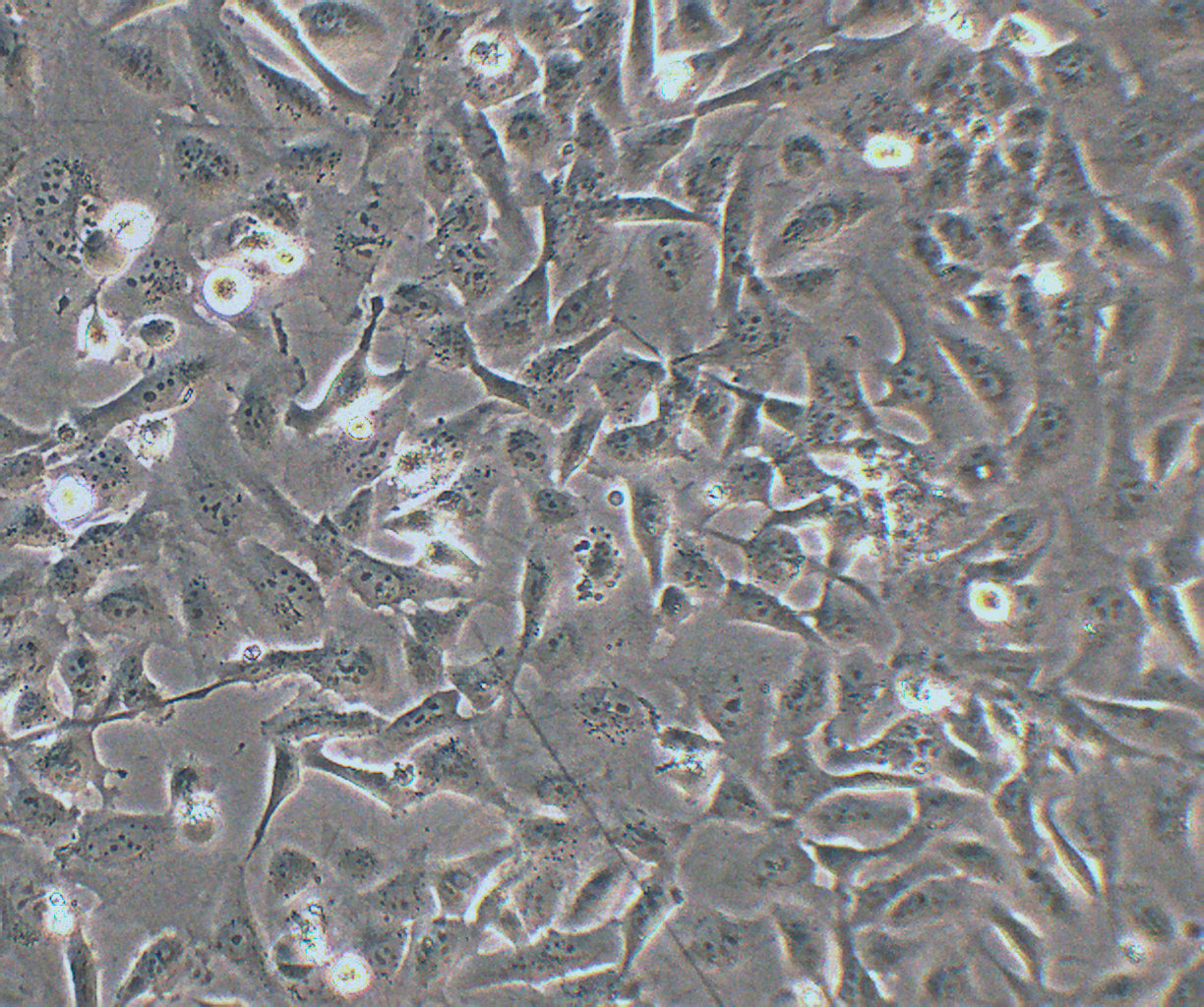 Nthy-ori 3-1 人甲状腺滤泡上皮细胞