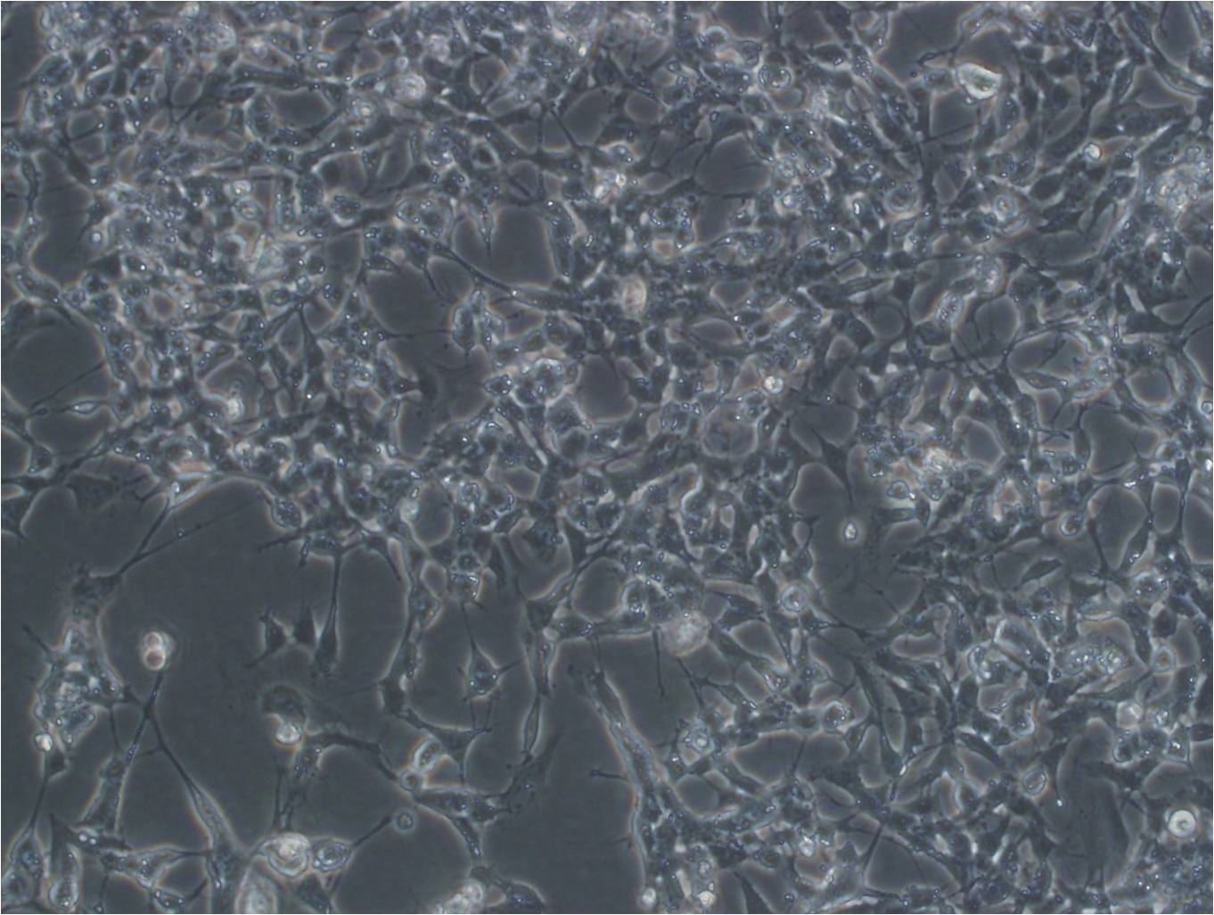 SK-N-BE(2) 人神经母细胞瘤细胞