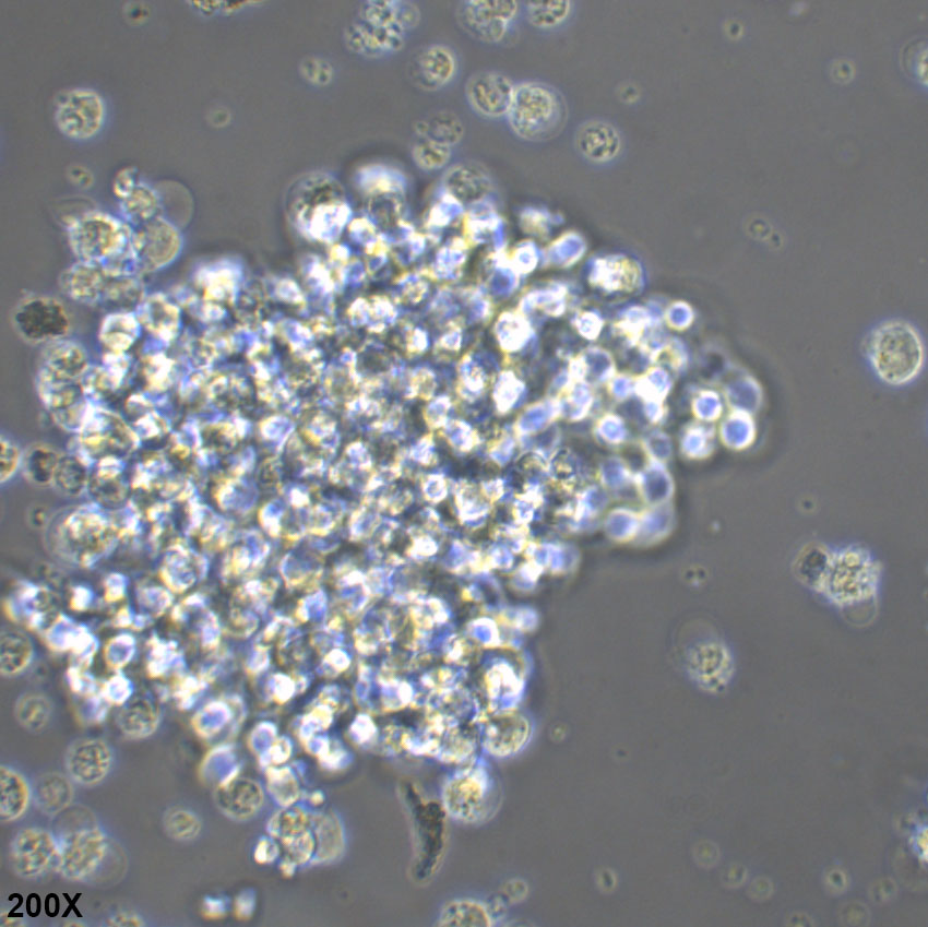 NK92/MI 人自然杀伤细胞淋巴瘤细胞
