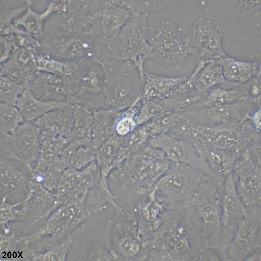 DU145 人前列腺癌细胞