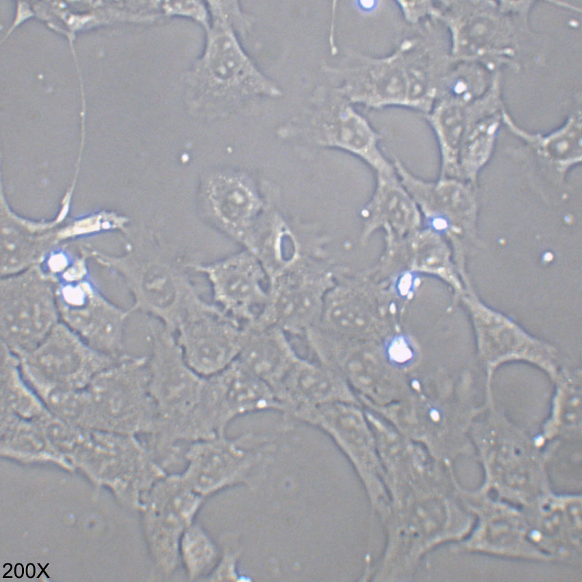 4T1 小鼠乳腺癌细胞