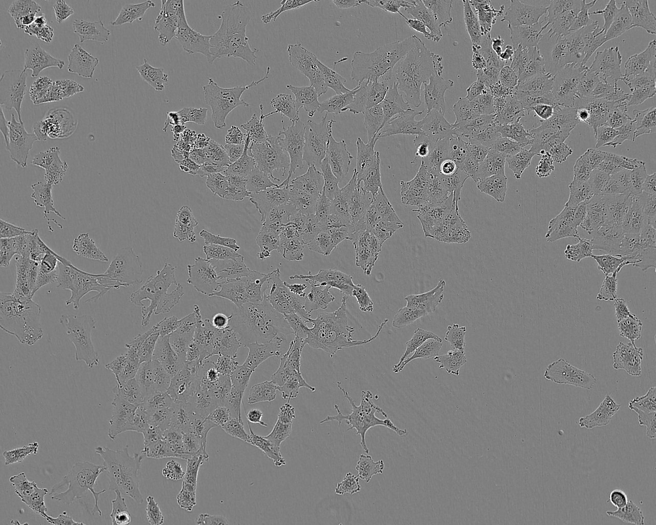 T98G 人脑胶质母细胞瘤