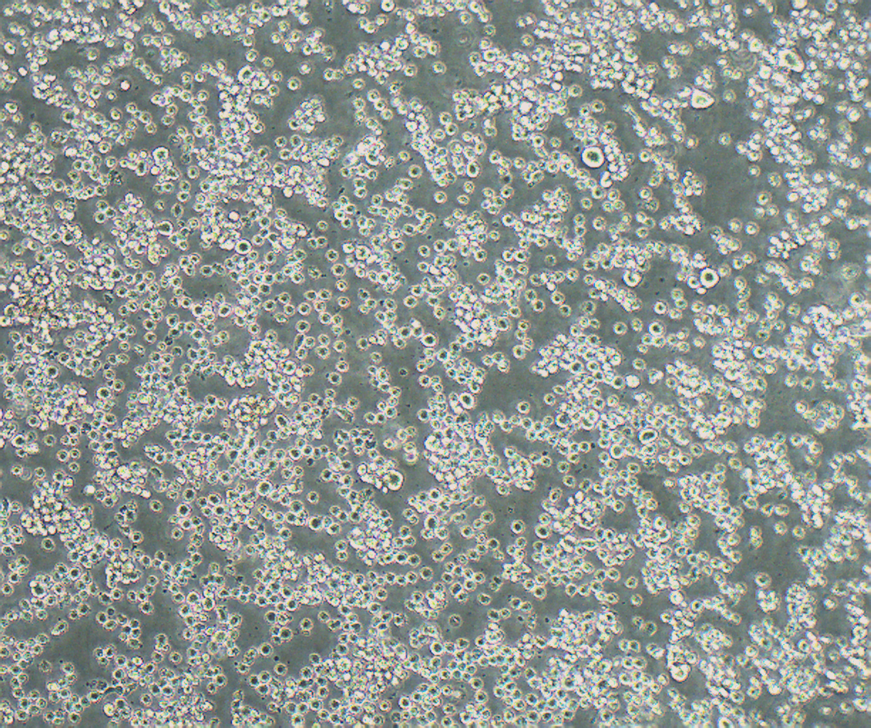 SU-DHL-2 人弥漫性组织淋巴瘤细胞