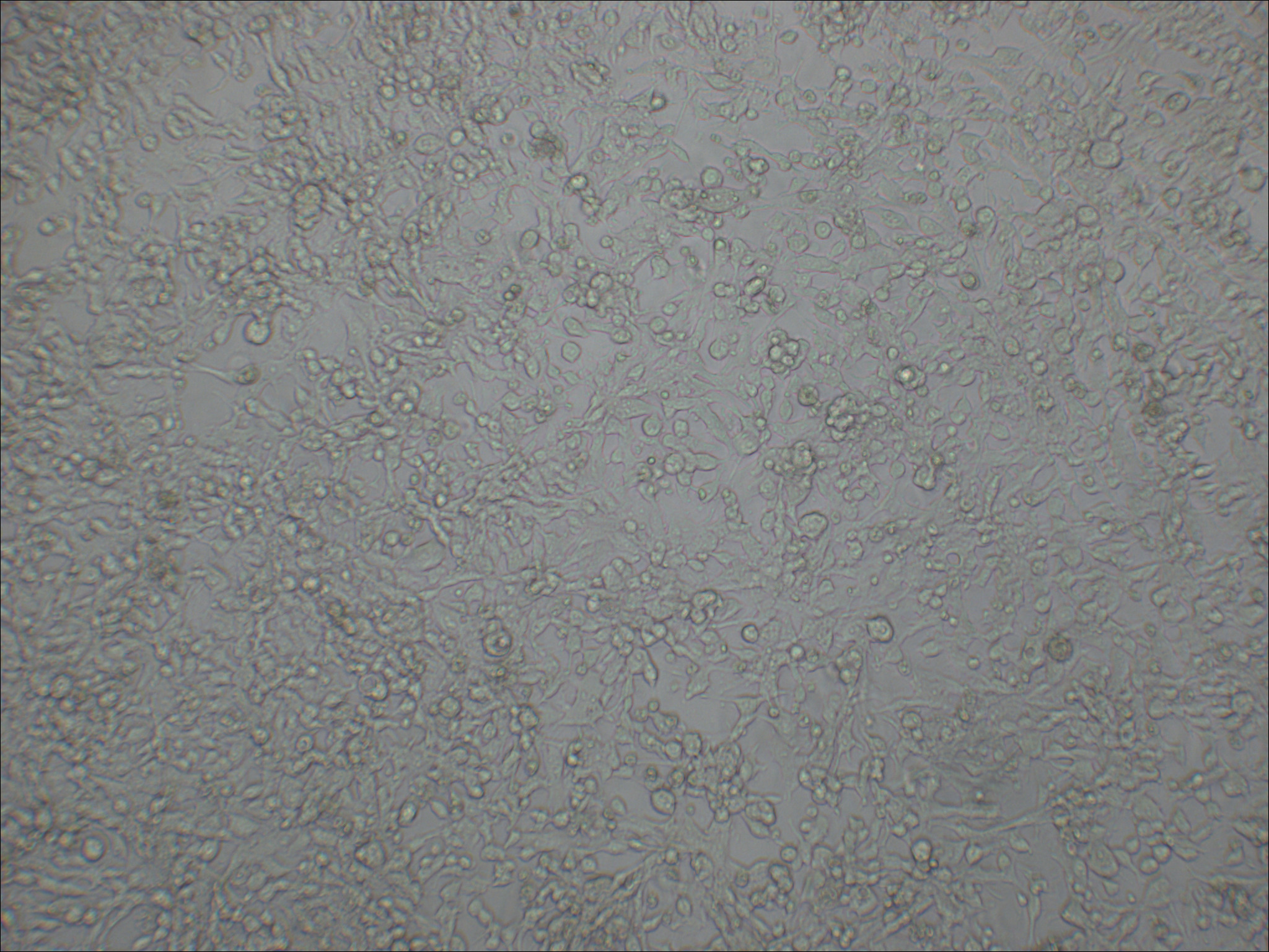 HePa1-6 小鼠肝癌细胞