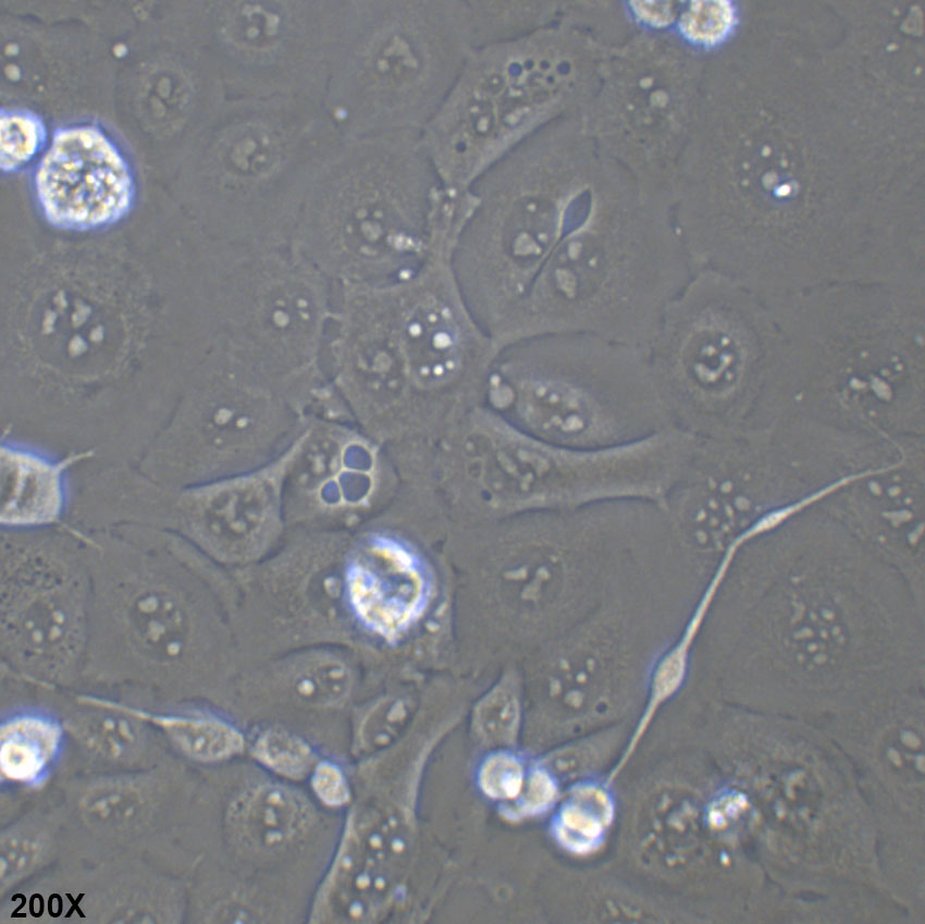 Kyse-30 人食管鳞癌细胞
