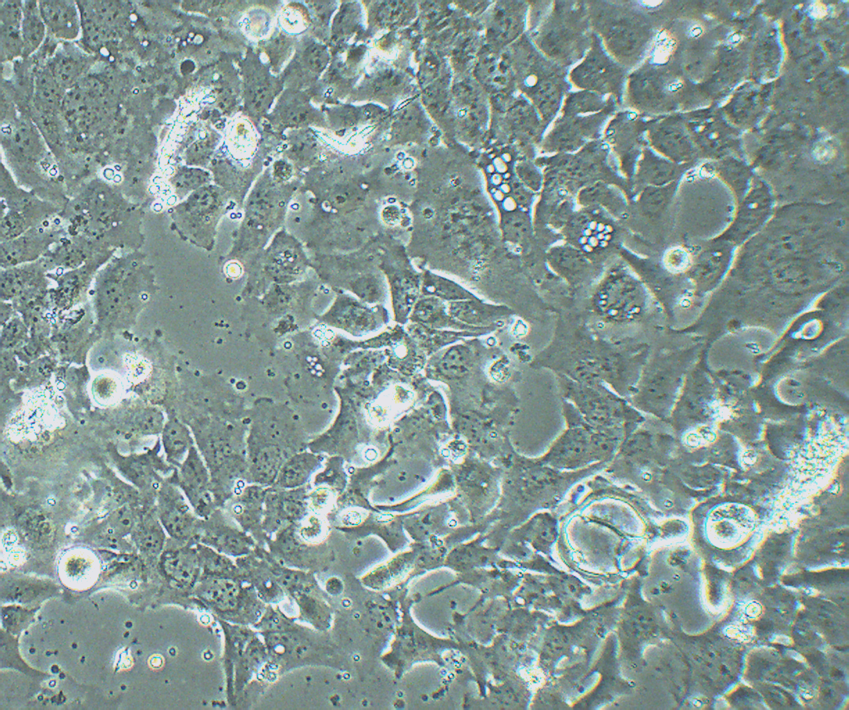 HCC1954 人乳腺导管癌细胞