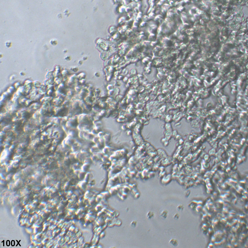 NCI-H526 人肺癌转移