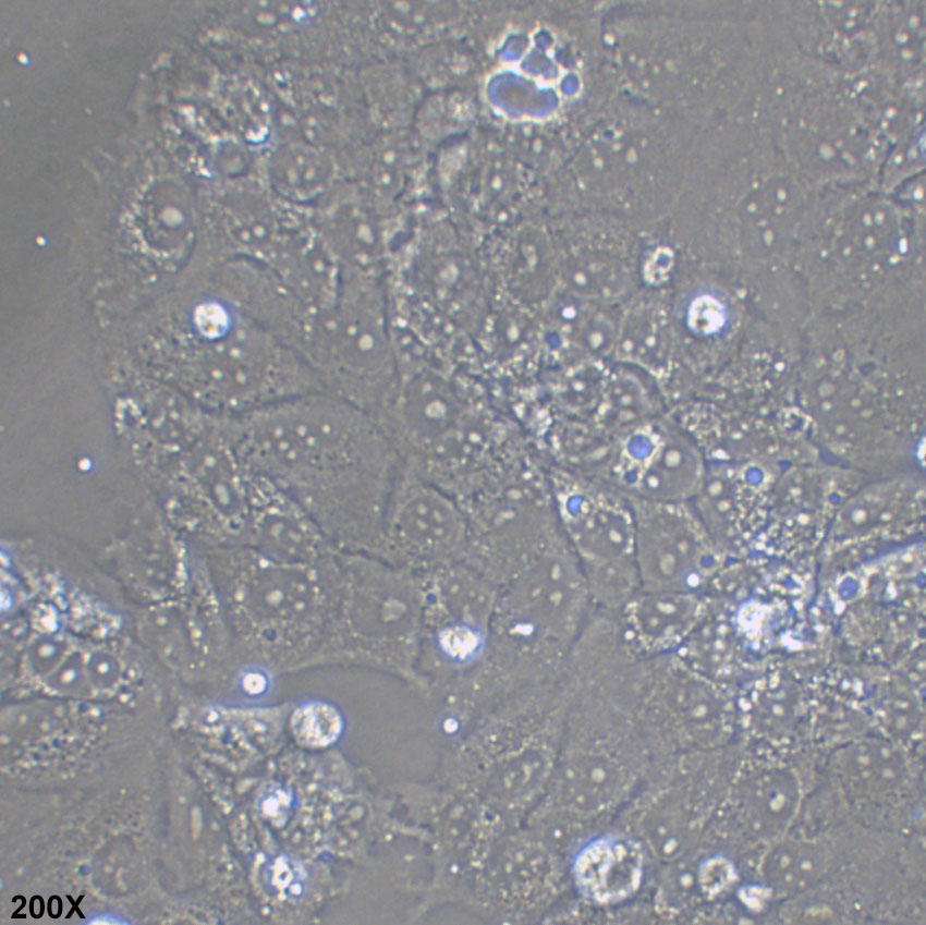 Huh-6 人肝母细胞瘤细胞