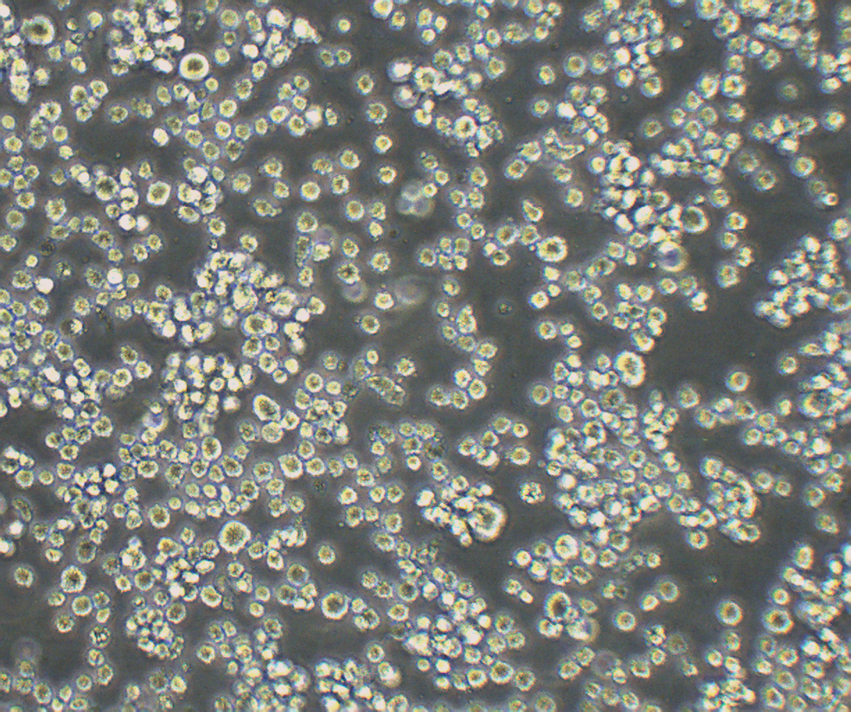 SU-DHL-2 人弥漫性组织淋巴瘤细胞