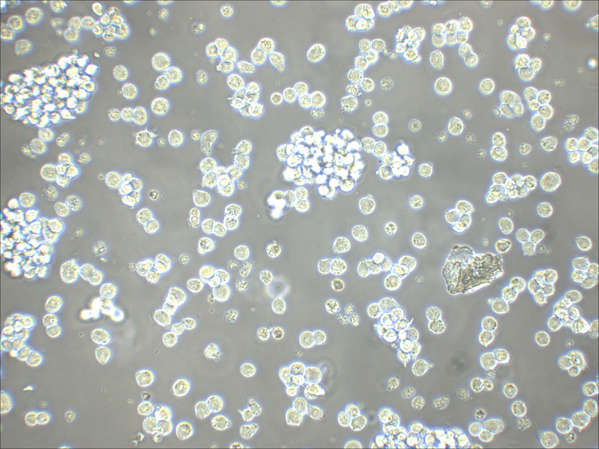 NB-4 人急性早幼粒白血病细胞