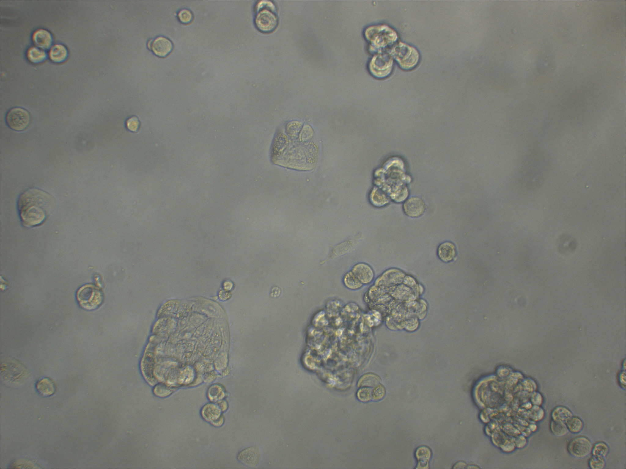 UACC812 人乳腺原导管瘤细胞