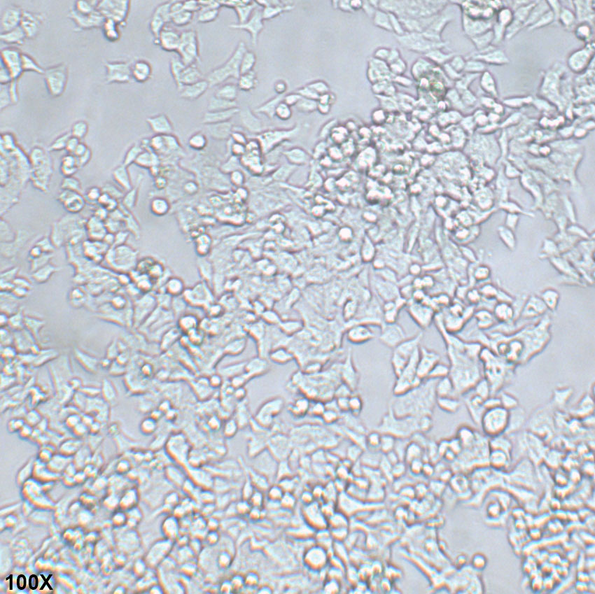 LS 174T 人结肠腺癌细胞