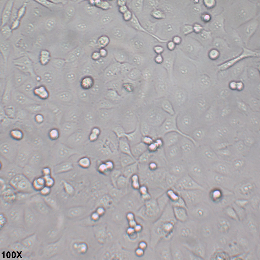 Kyse-30 人食管鳞癌细胞