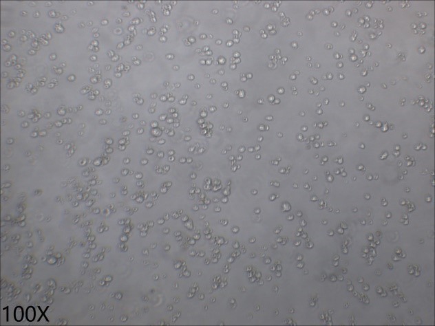 KARPAS-422 人B细胞淋巴瘤细胞