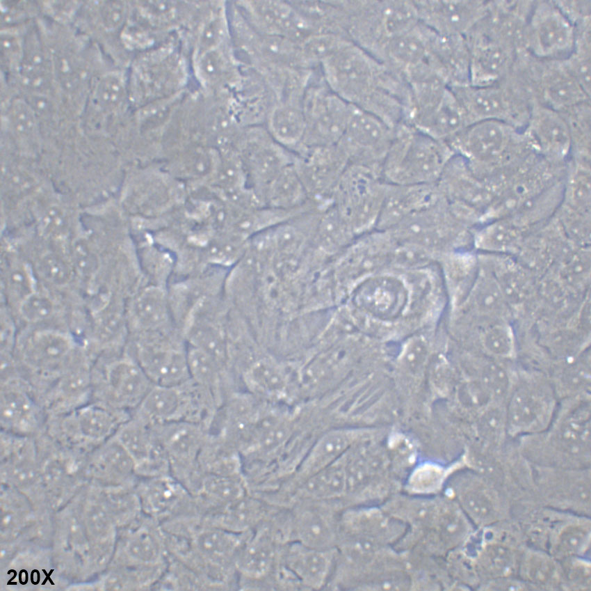 SK-MES-1 人肺鳞癌细胞