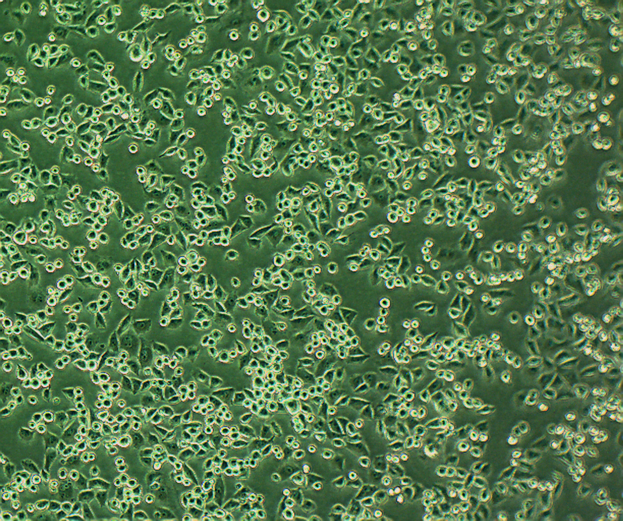 U14 小鼠子宫颈癌细胞