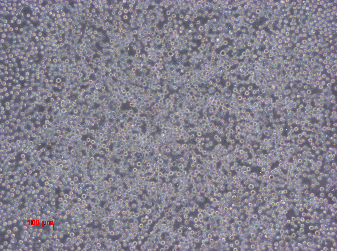 KU812 人外周血嗜碱性白血病细胞