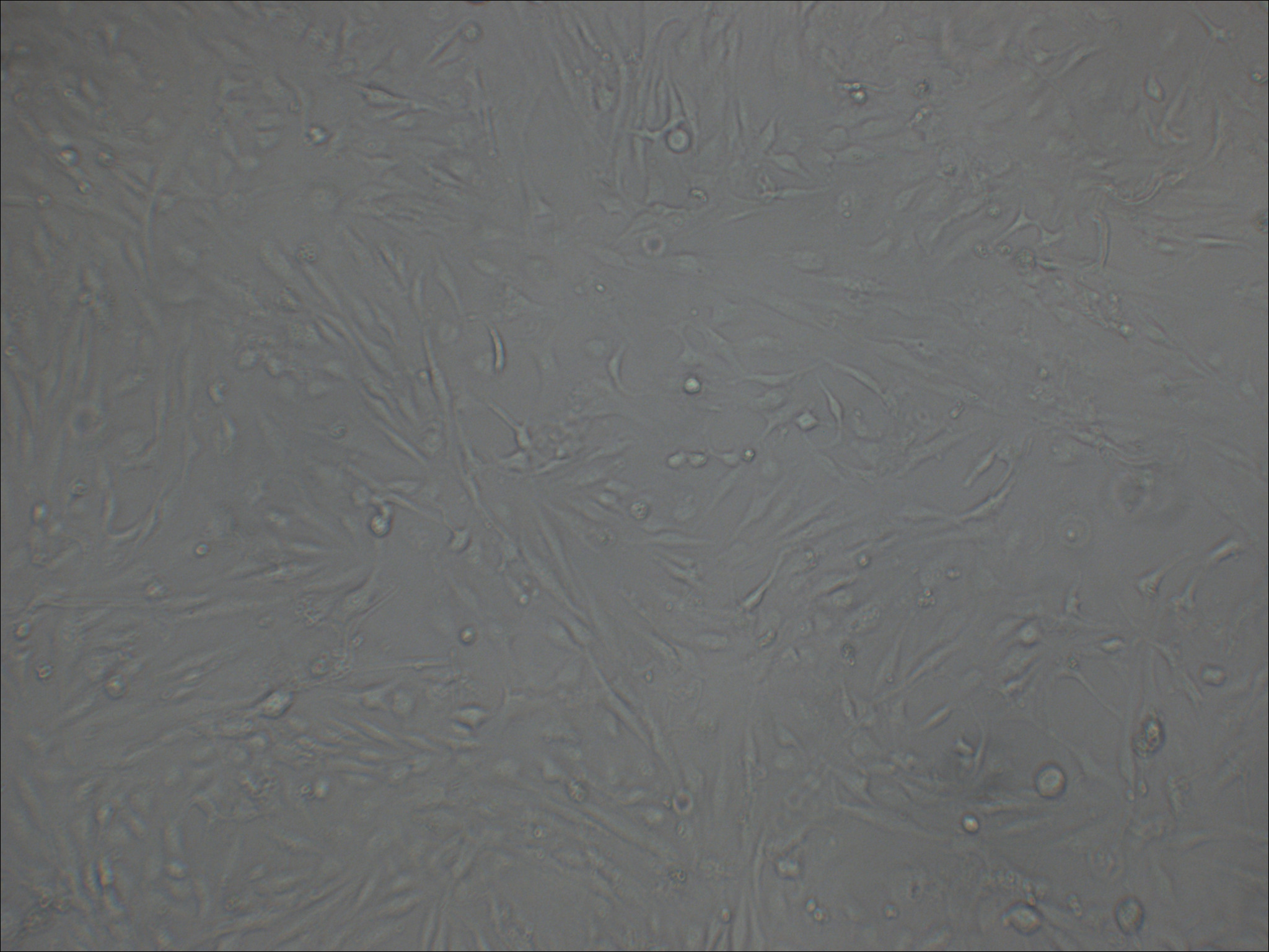 8305C 人甲状腺癌细胞（退行性）