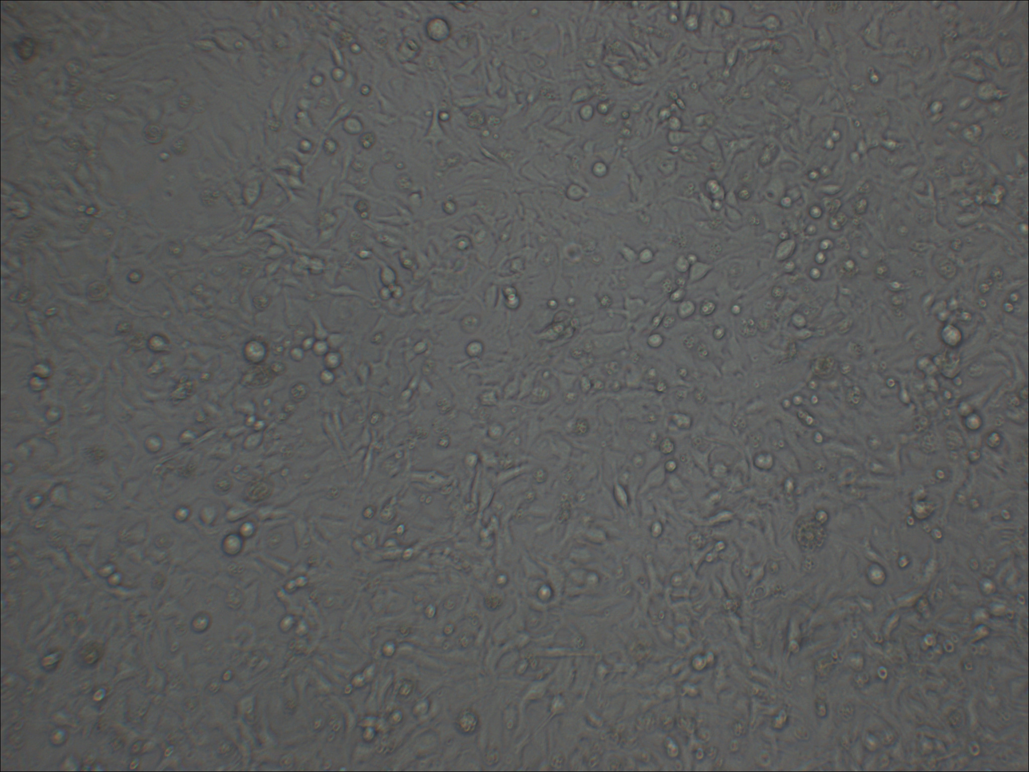 Kyse-410 人食管鳞癌细胞