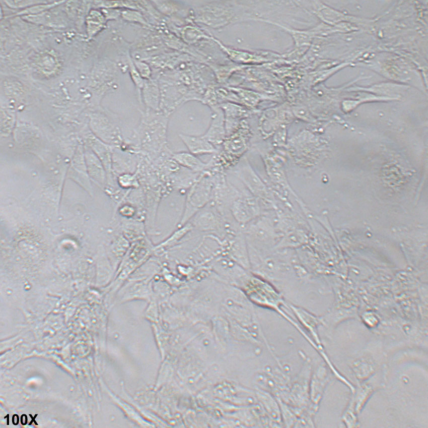 SW1088 人脑星形胶质细胞瘤细胞