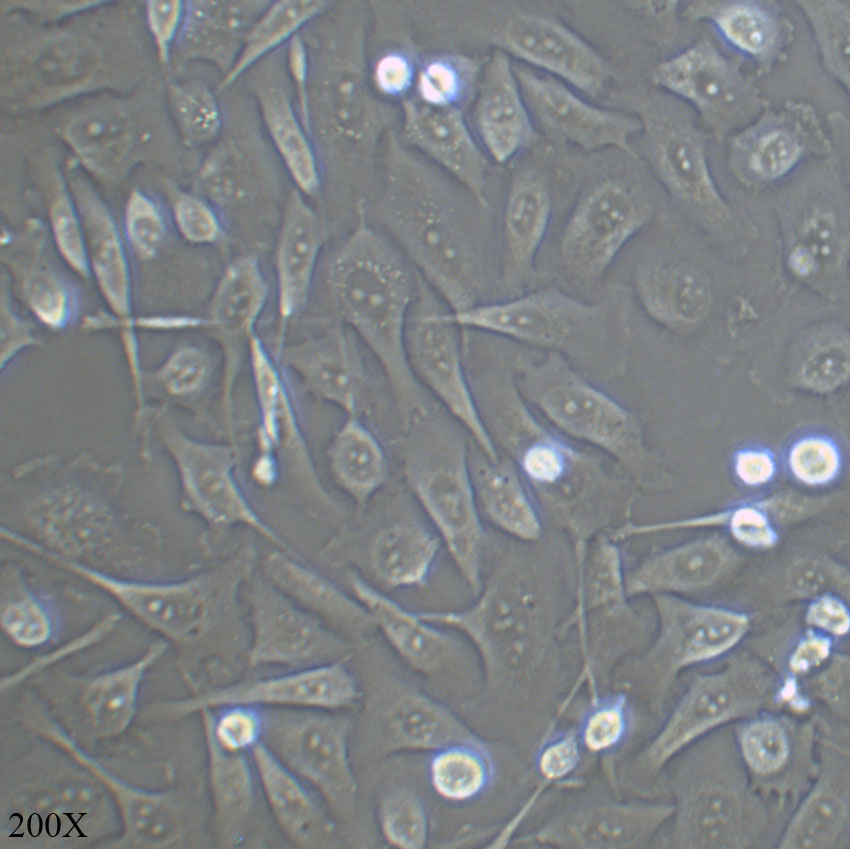 PC3 人前列腺癌细胞