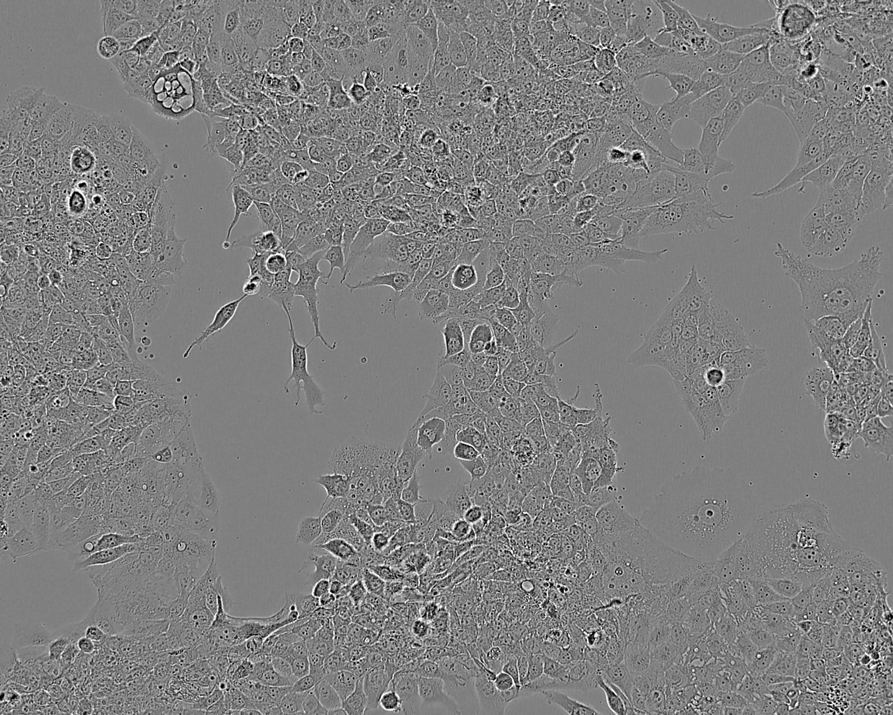 BeWo 人胎盘绒膜癌细胞