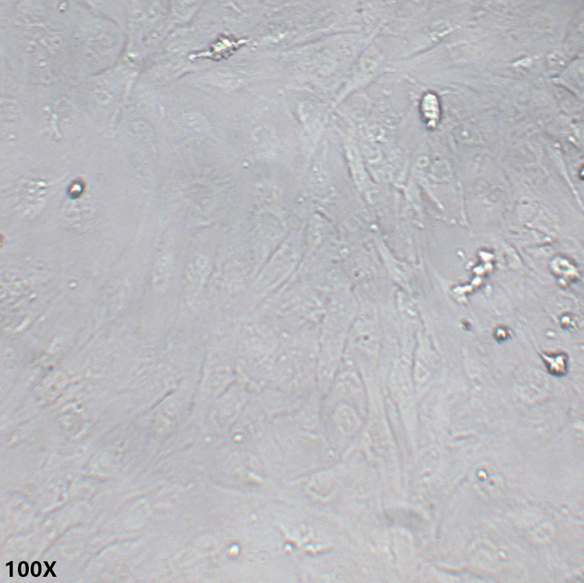 SNU-387 人多形性肝癌细胞