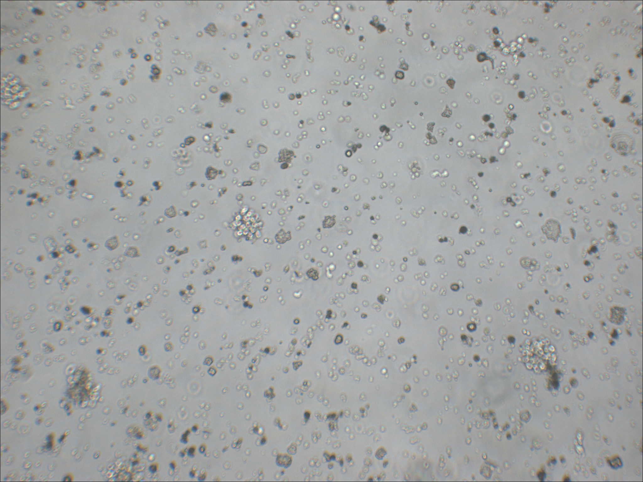 NK92 人自然杀伤细胞淋巴瘤细胞