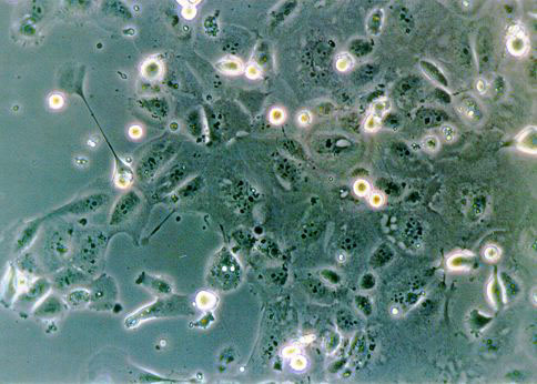 HUCC-T1 人胆管上皮癌细胞