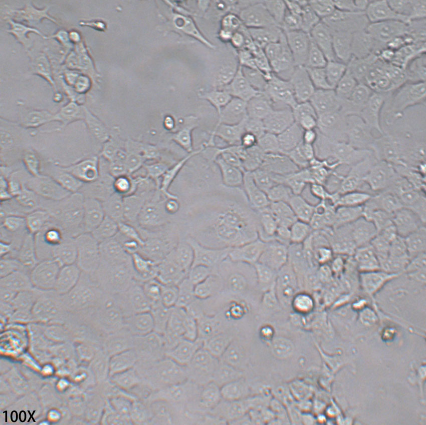 FaDu 人咽鳞癌细胞
