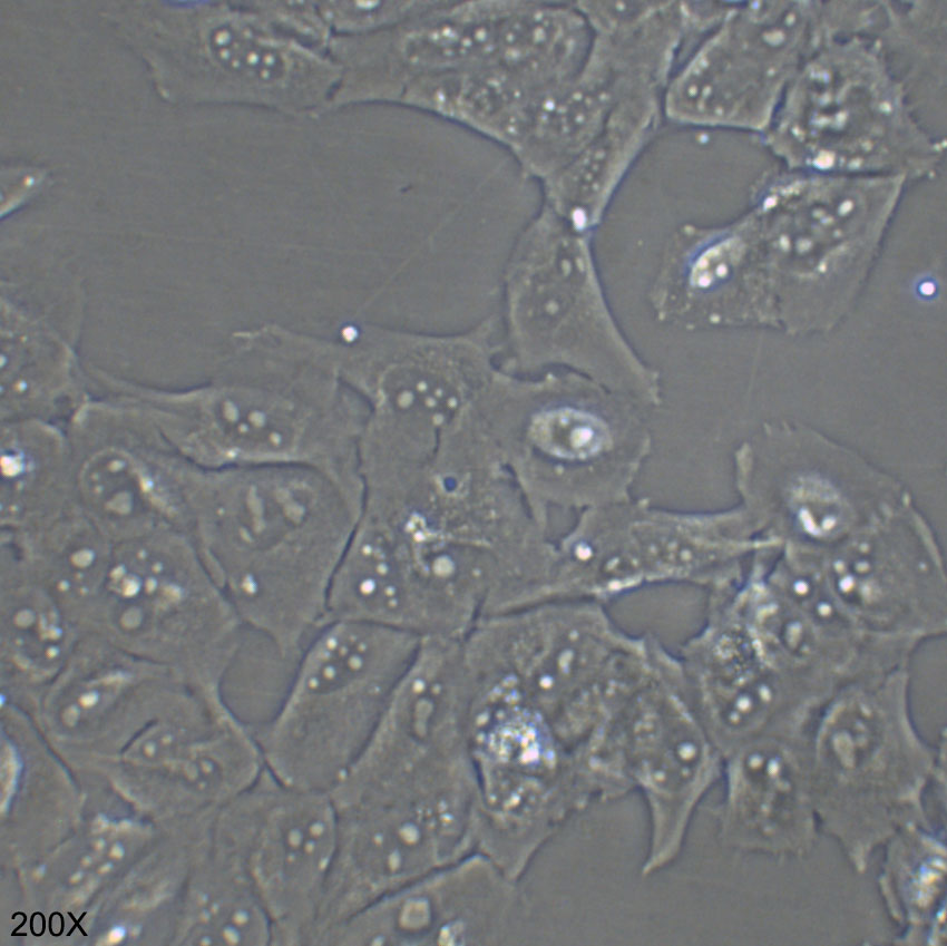 KMH-2 人甲状腺癌细胞（退行性）