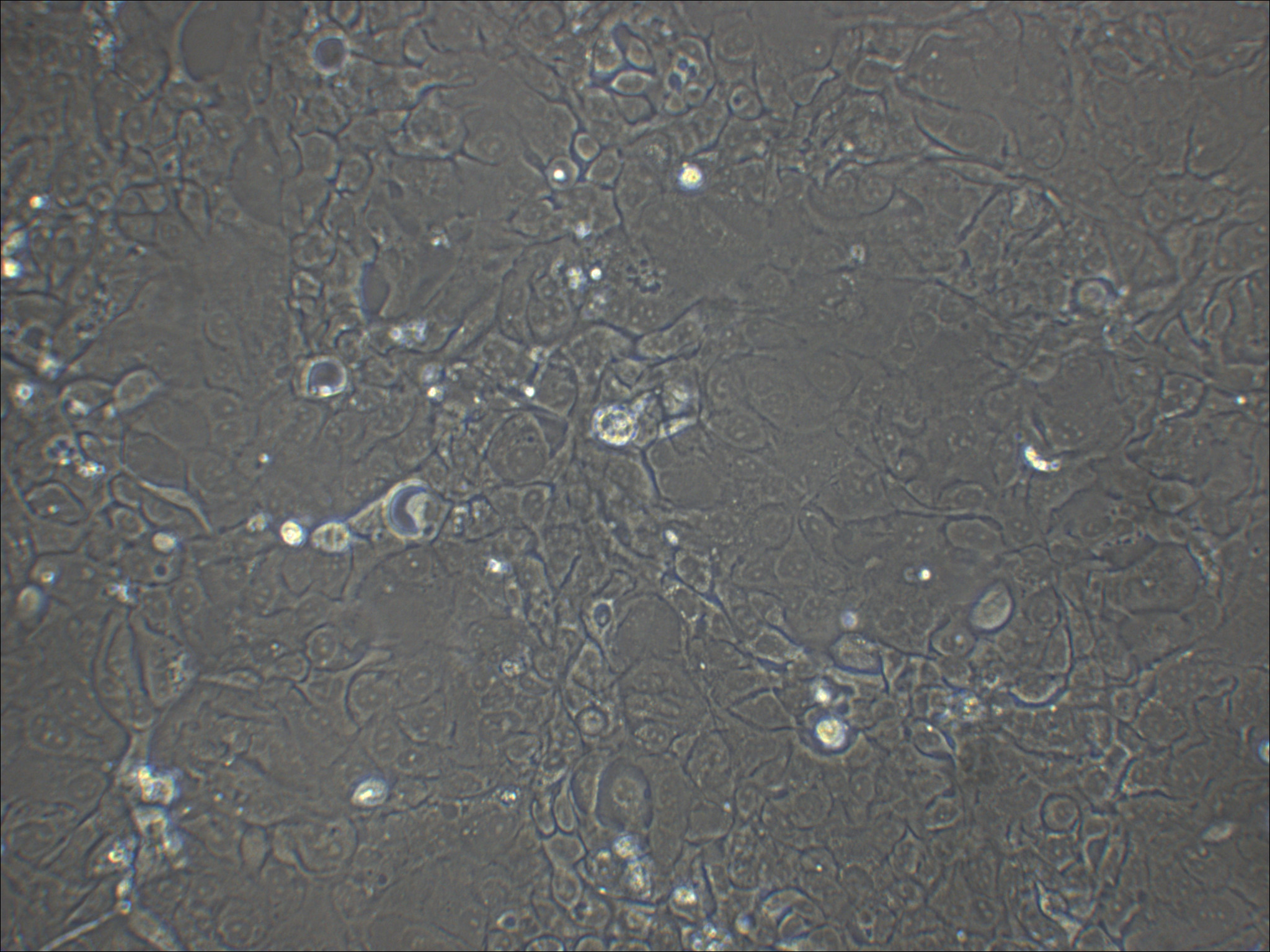 PK136 小鼠杂交瘤细胞