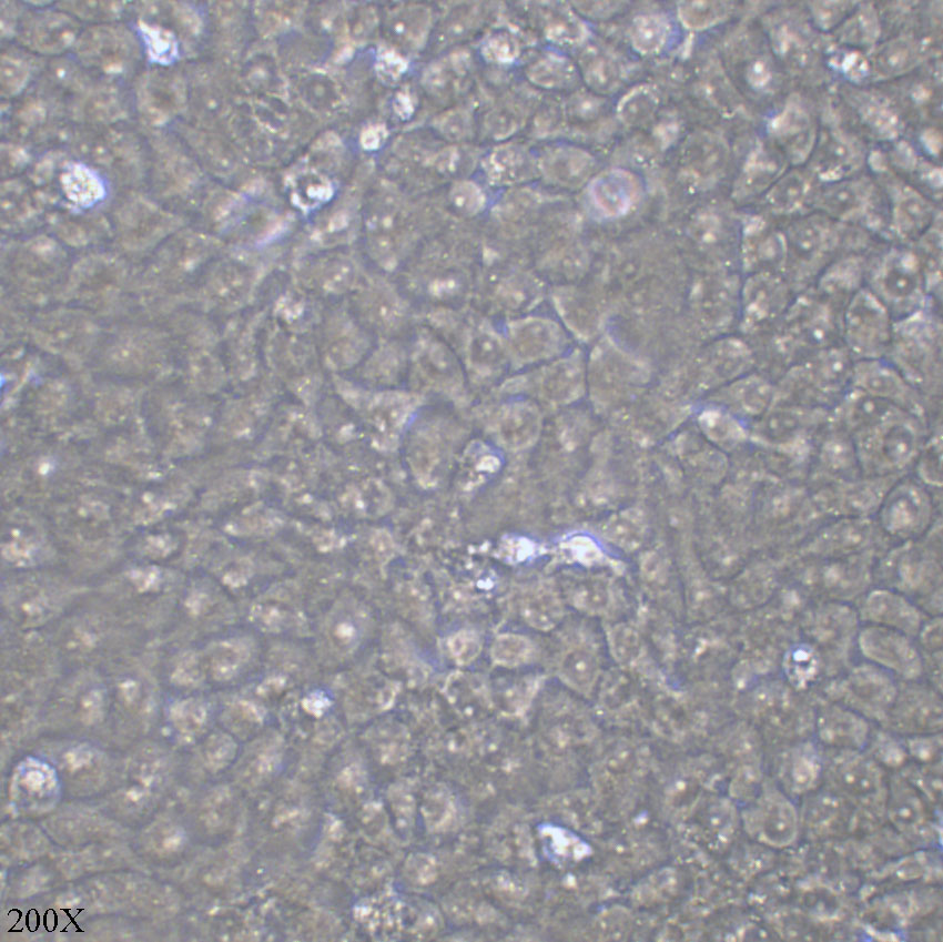 Cal-27 人舌鳞癌细胞