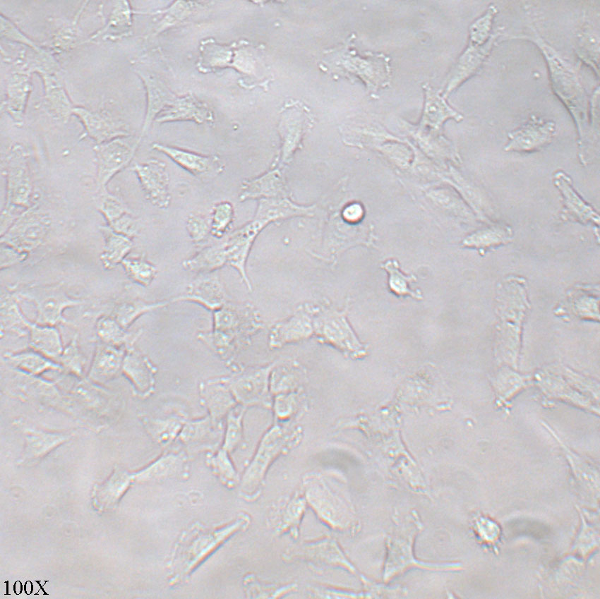 SW579 人甲状腺鳞癌细胞