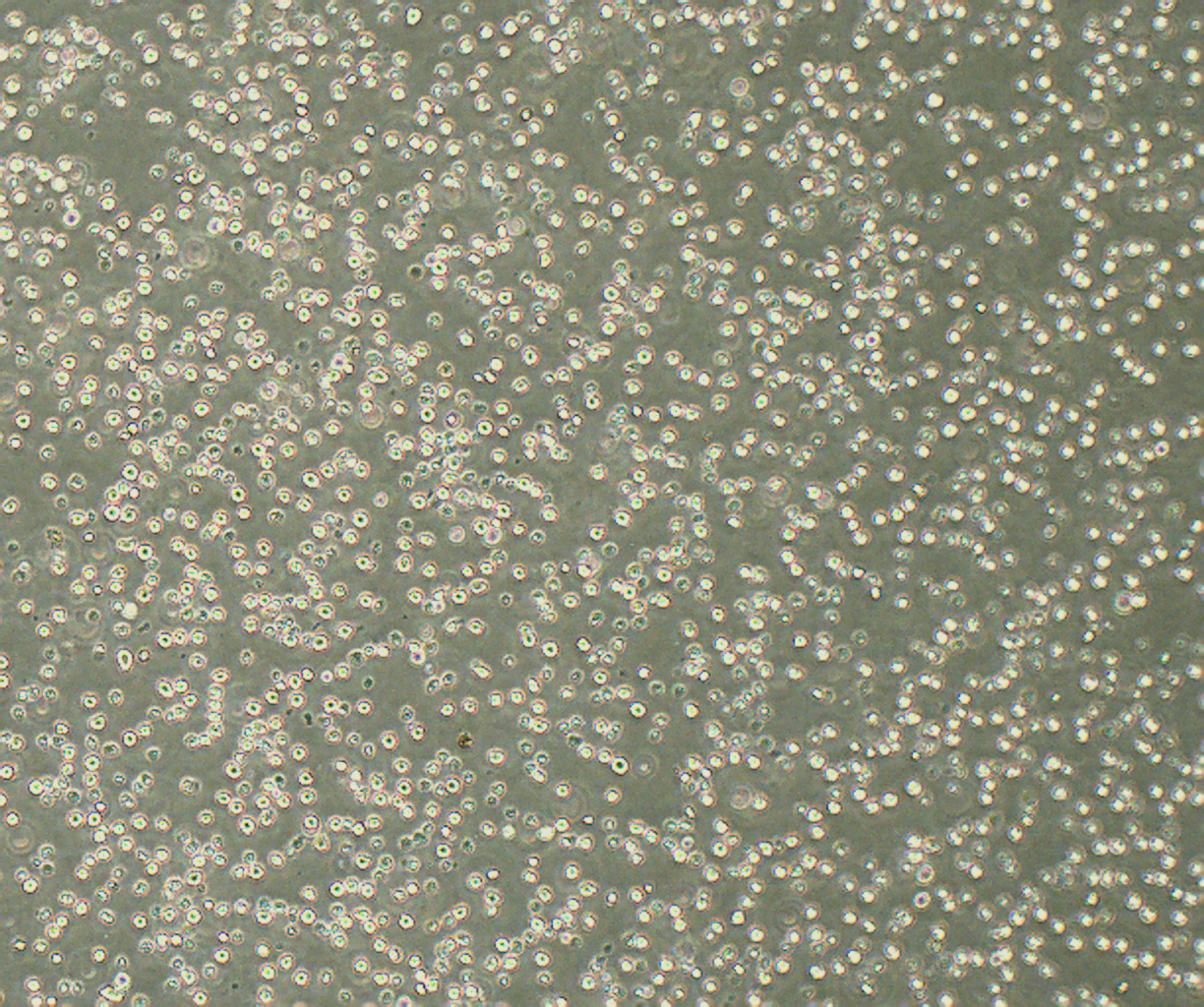 MV-4-11 人髓性单核细胞白血病细胞