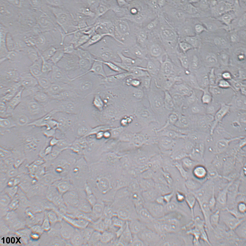HT-1080 人纤维肉瘤细胞