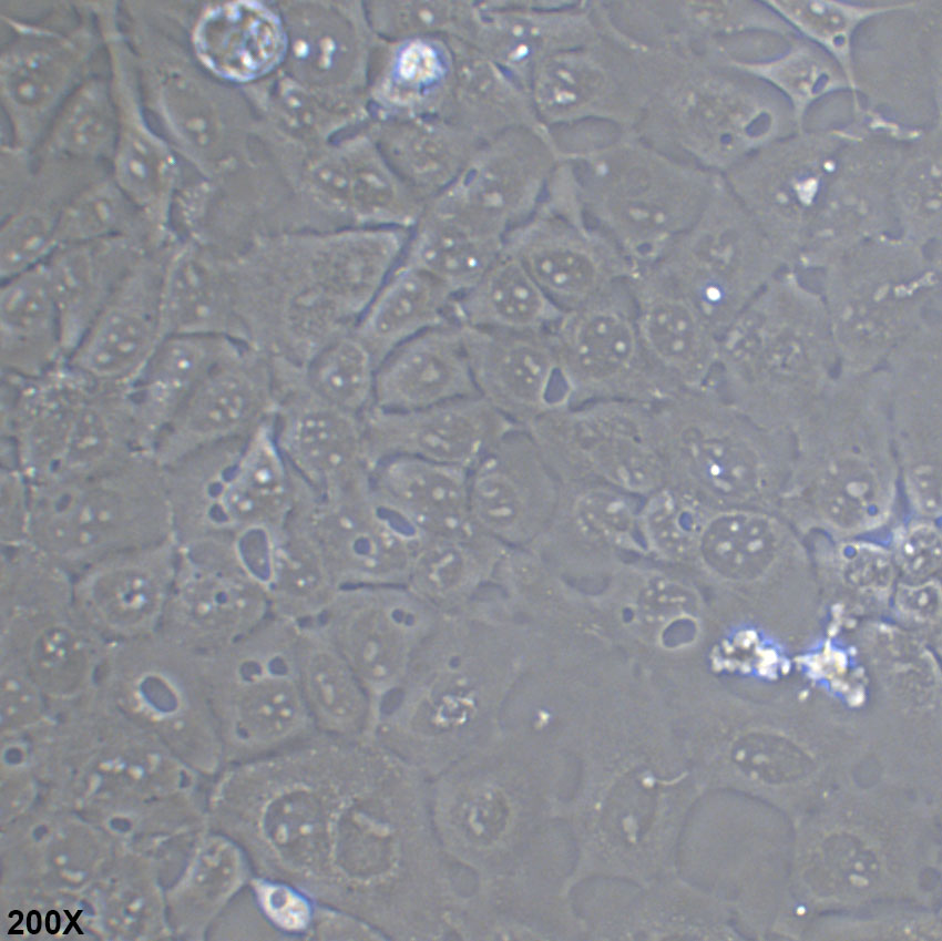 Kyse-140 人食管鳞癌细胞