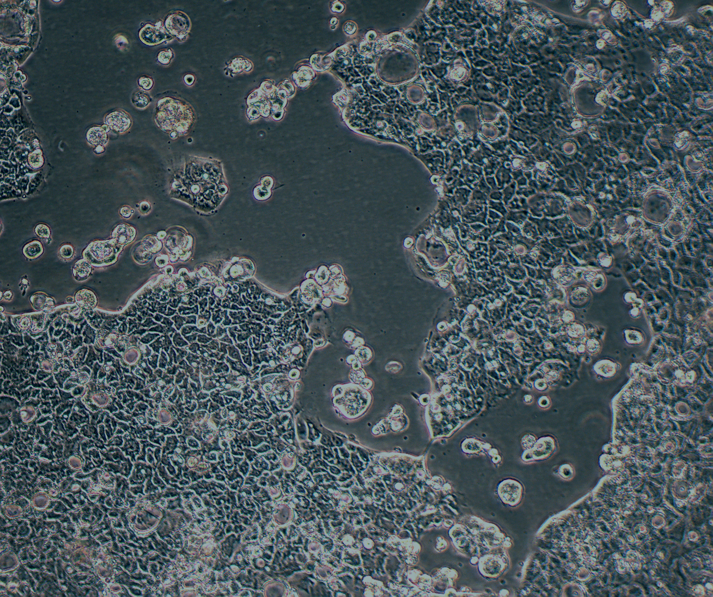 Caco-2 人结直肠腺癌细胞