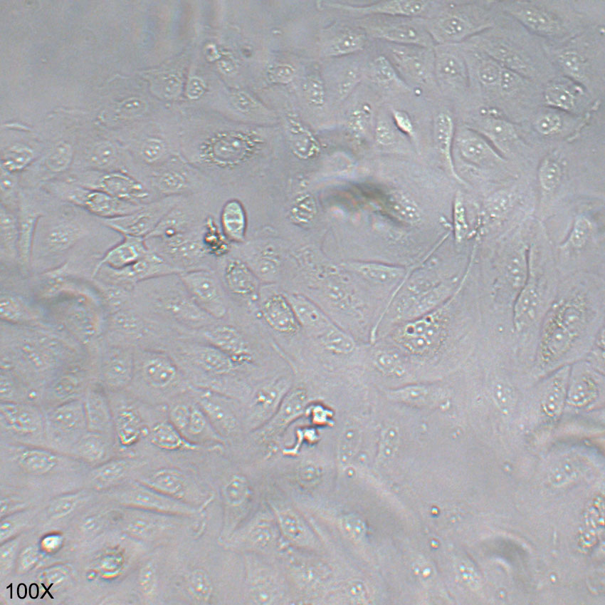 GBC-SD 人胆囊癌细胞