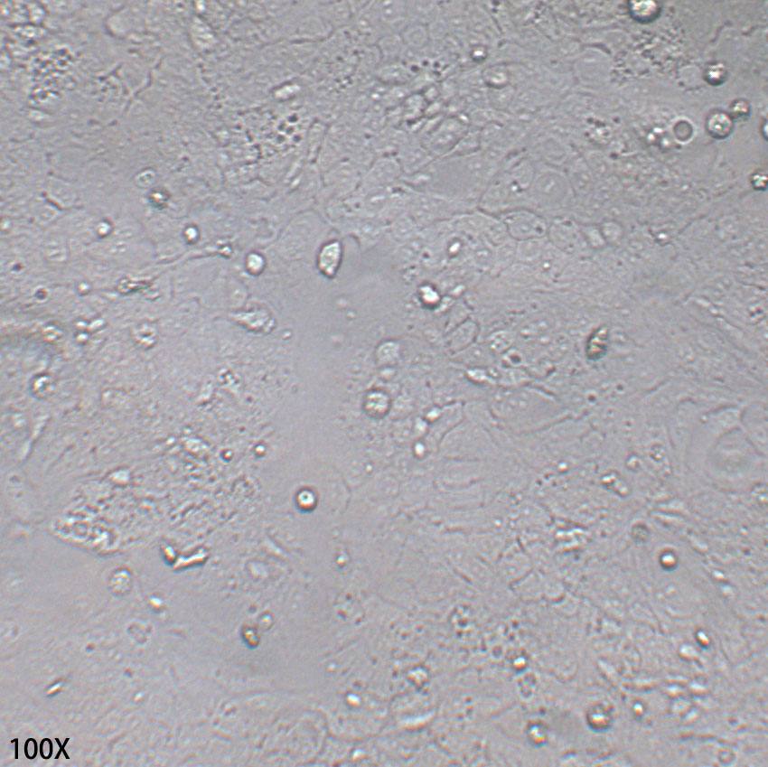 Ishikawa 人子宫内膜癌细胞