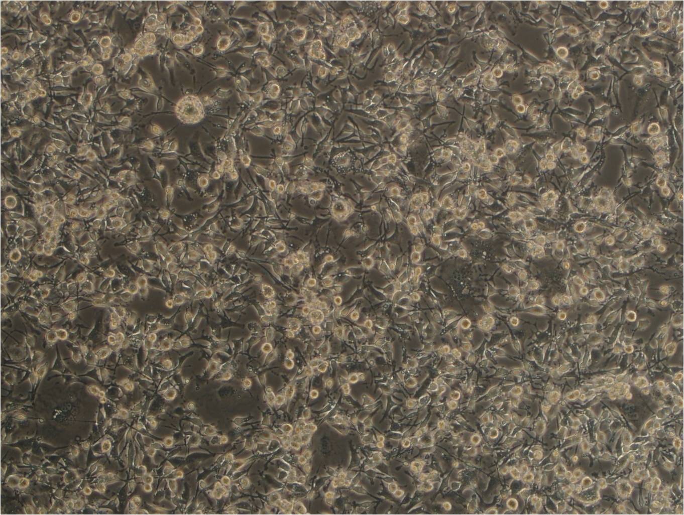 MDA-MB-436 人乳腺腺癌细胞