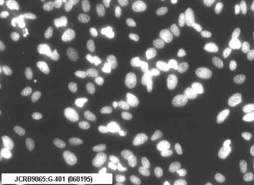 G-401 人肾癌Wilms细胞