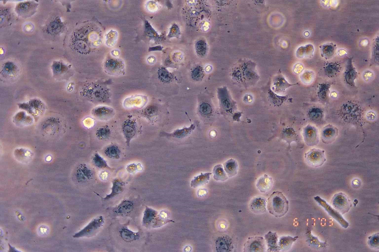 SW-13 人肾上腺皮质小细胞癌细胞