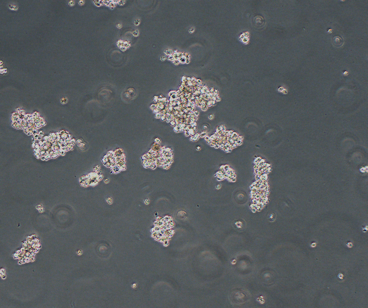 LP-1 人多发性骨髓瘤细胞