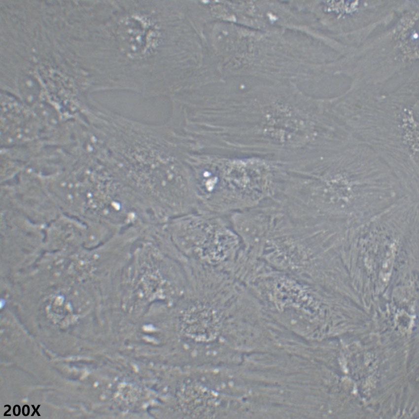 SNU-387 人多形性肝癌细胞