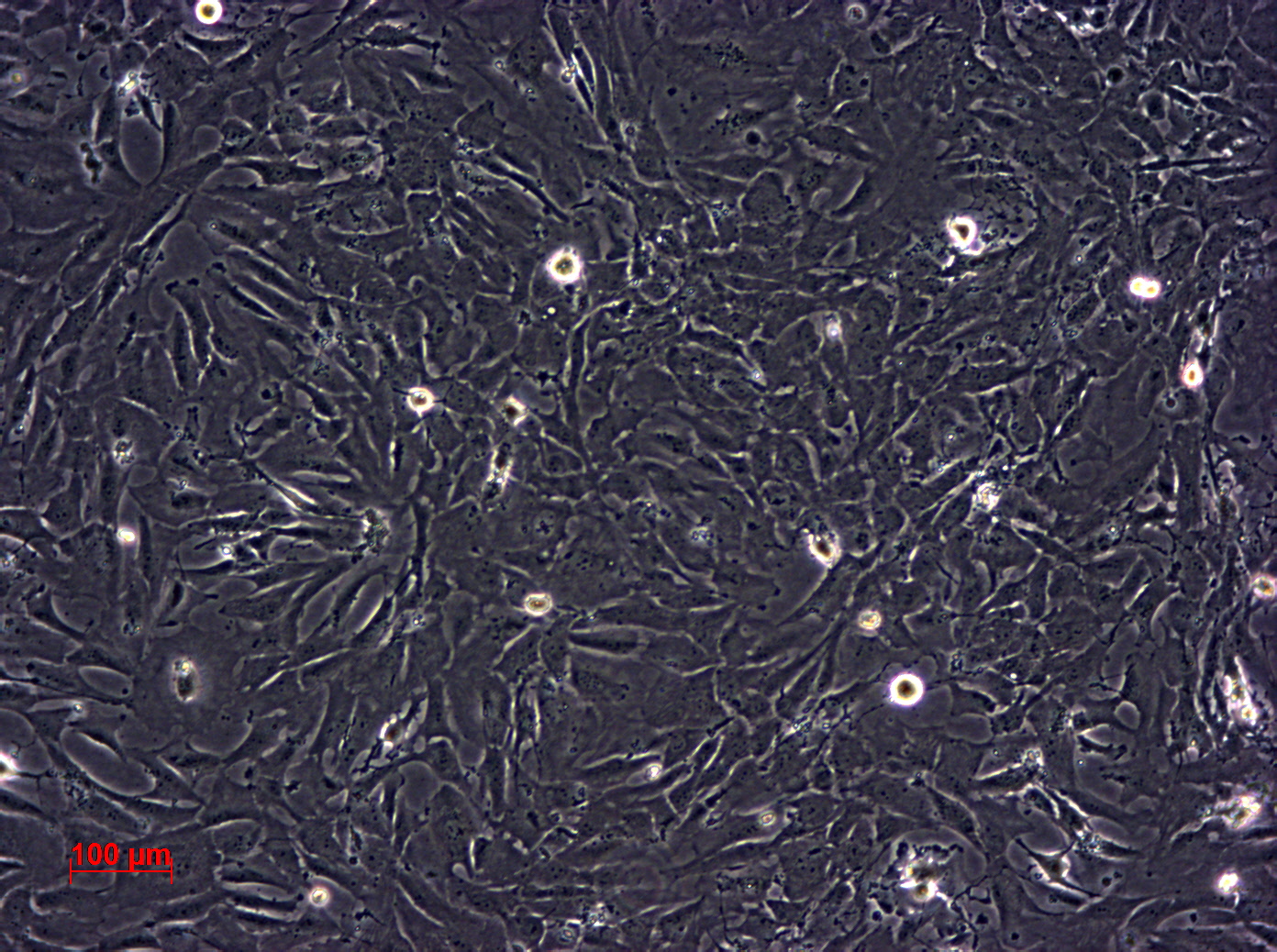 HS 578T 人乳腺癌细胞