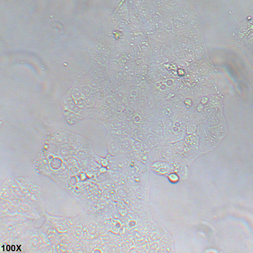 JEG-3 人绒毛膜癌细胞