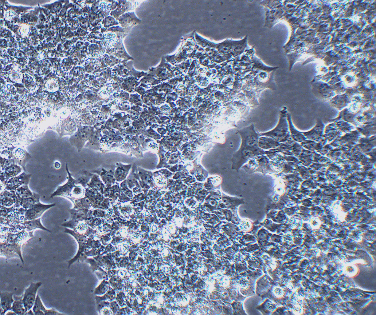 BT-474 人乳腺导管瘤细胞