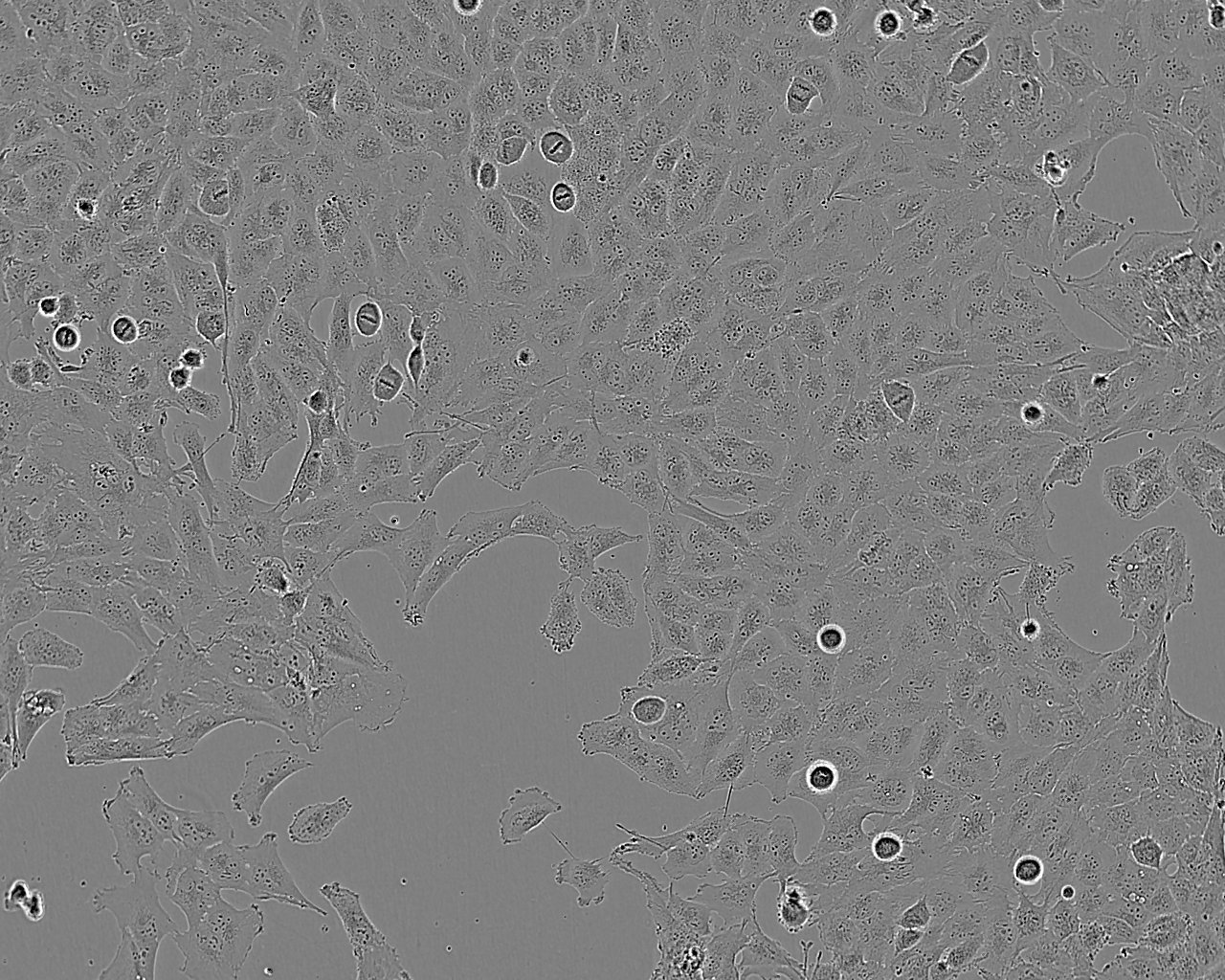 T98G 人脑胶质母细胞瘤